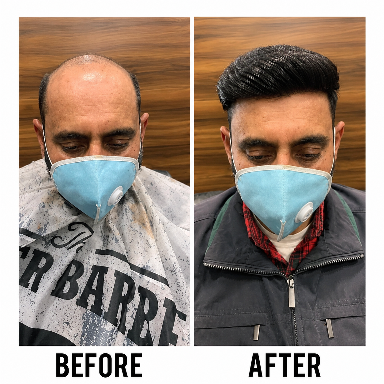 Hair transformation before and after — Indira Hair Weaving Centre, Chandigarh